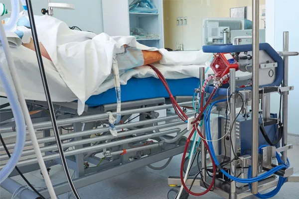 ECMO à beira-leito em unidade de terapia intensiva